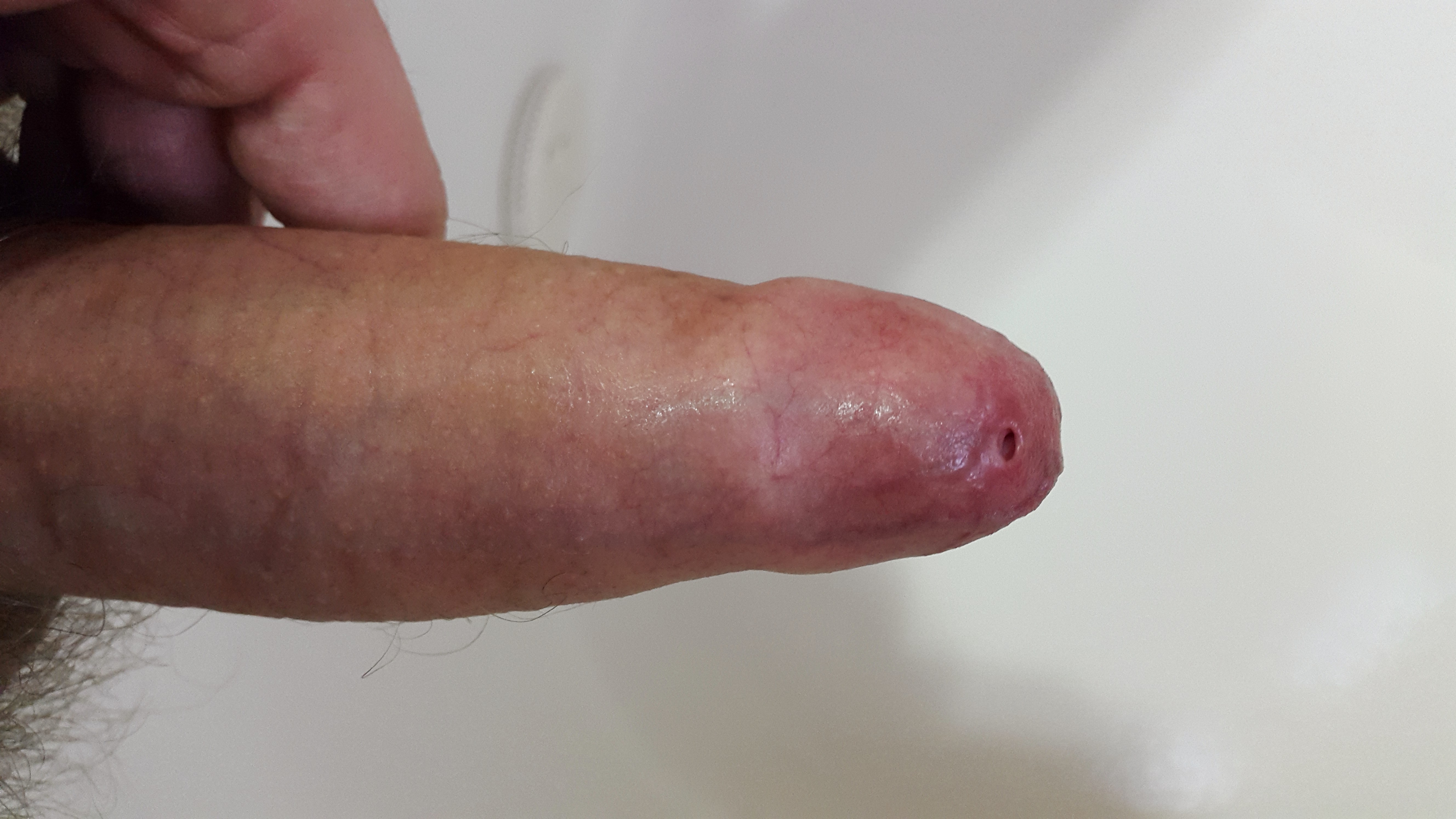 Willy wrap penis foreskin hairy uncut