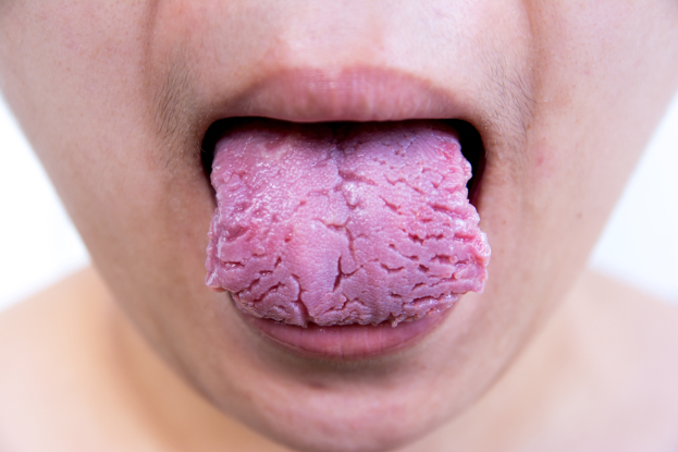 Tongue tonsils throat examination
