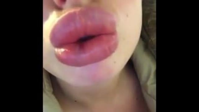 Inflated plastic lips