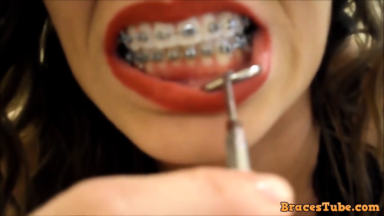 best of Vore mouth braces