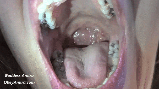 Earnie recommendet tongue tonsils throat examination